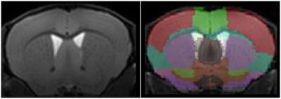 The contribution of preclinical magnetic resonance imaging and spectroscopy to Huntington’s disease